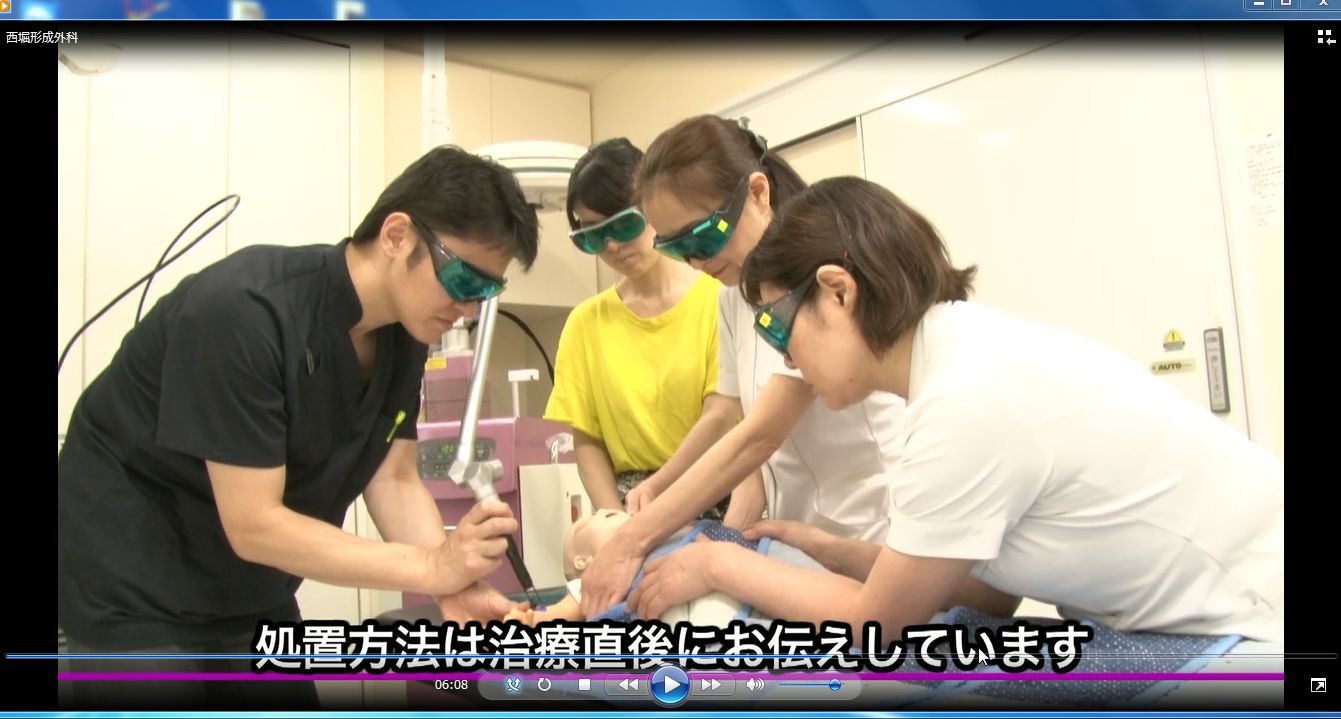 おさえレーザー　WS000019.JPG