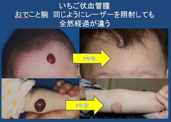 いちご 場所でちがう WS000023.JPG