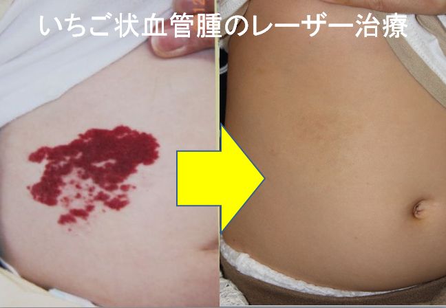 あかあざ いちご WS000005.JPG