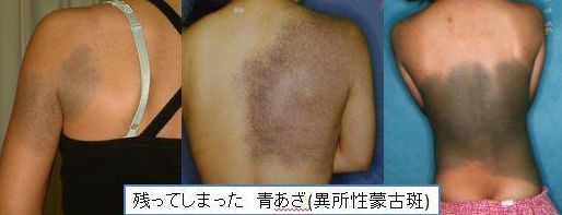 あおあざ いざん WS000031.JPG