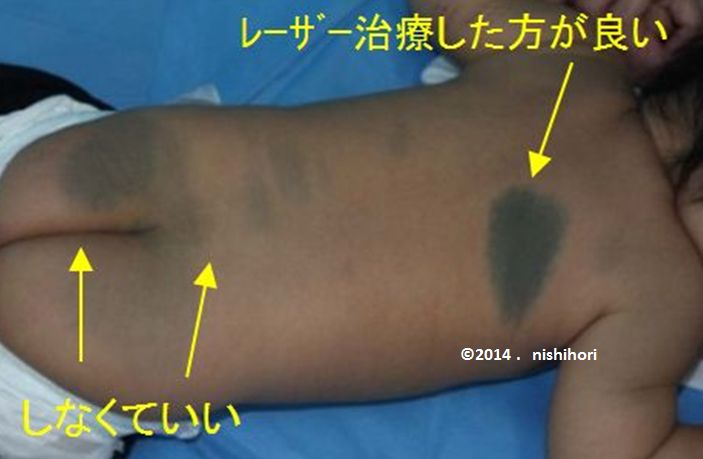 ああおあざ きじゅん めやすWS000017.JPG
