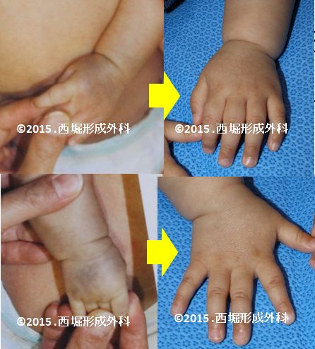 WS000156 (2).JPG