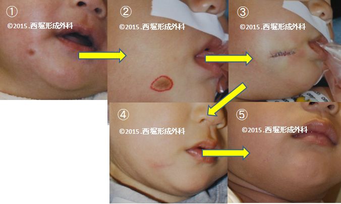 WS000000 (2).JPG