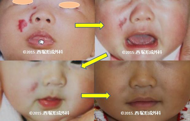 WS000059 (2).jpg