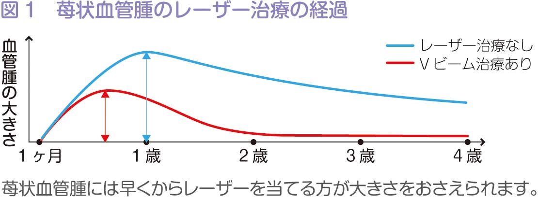 Vヒ_ームク_ラフ.jpg